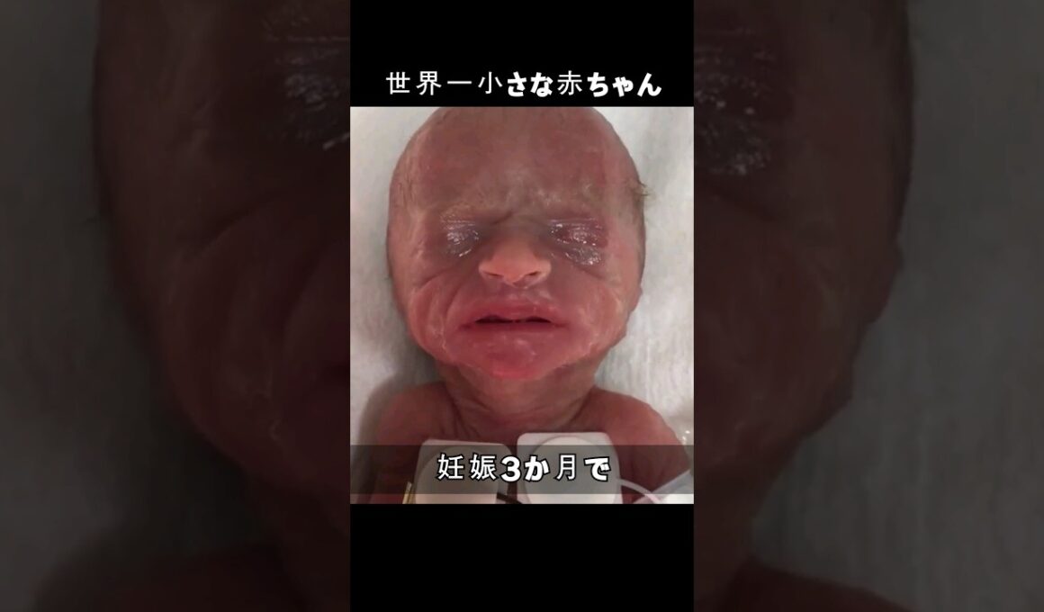 世界一小さな赤ちゃん