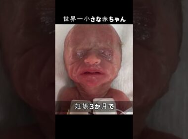 世界一小さな赤ちゃん