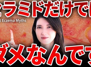 【アトピーが改善しない理由】セラミドを塗るだけだと悪循環です。女医友利新が正しい対処法とスキンケアを話します