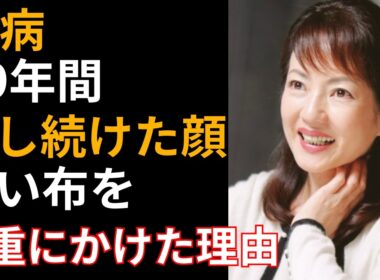 五十嵐淳子「急病」 49年間隠し続けた“顔”―― 夫はなぜ白い布を二重にかけたのか