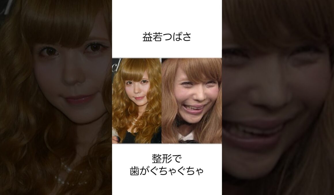 実は整形に失敗した芸能人10選#shorts #雑学