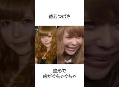 実は整形に失敗した芸能人10選#shorts #雑学