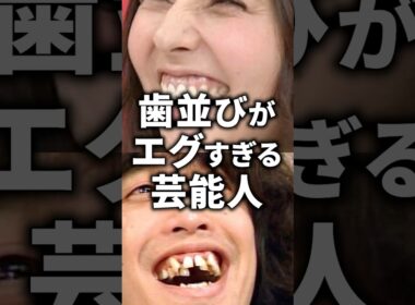 ㊗️100万再生！歯並びがえぐい芸能人！