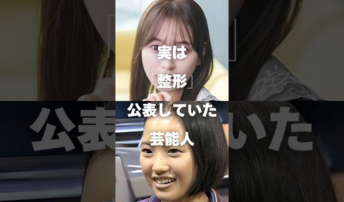【注目】実は「整形」を公表していた芸能人まとめ#shorts #芸能人 #芸能