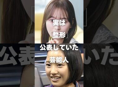 【注目】実は「整形」を公表していた芸能人まとめ#shorts #芸能人 #芸能