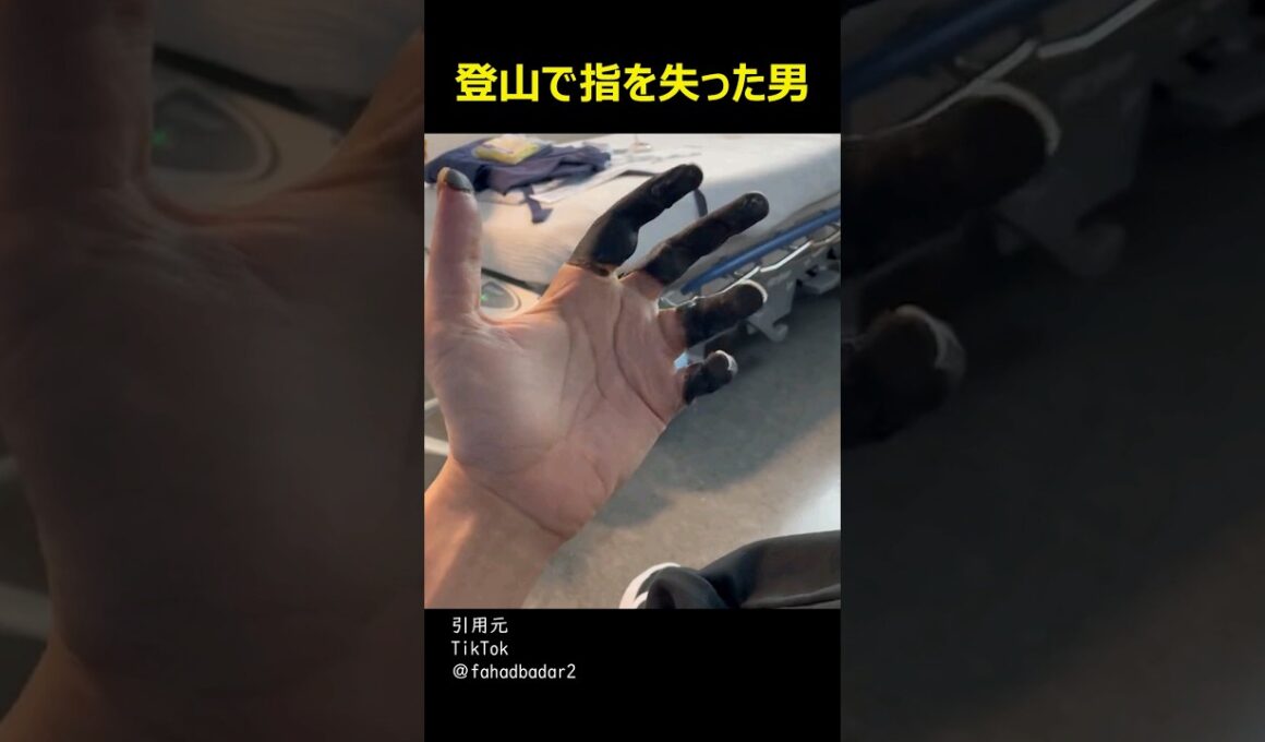 登山で指を失った男