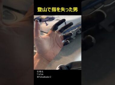 登山で指を失った男