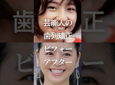 芸能人の歯列矯正ビフォーアフターPart3　#ガルちゃん #芸能人 #歯列矯正