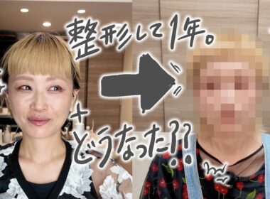 【告白】整形から１年経った顔面はどうなったのか。【ロシアン佐藤】【RussianSato】
