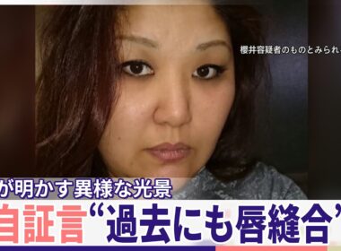 【独自証言】「自ら唇を縫っていた」同居女性傷害事件、知人が明かす異様な光景 50歳女は関与否定【news LOG】