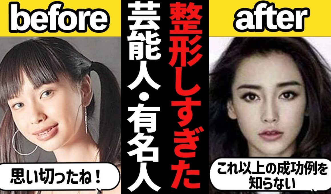 【ガルちゃん芸能】大成功＆大失敗！？なぜこんなに変わってしまった・・整形しすぎた芸能人・有名人【有益2ch】