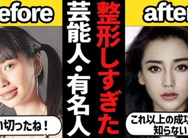 【ガルちゃん芸能】大成功＆大失敗！？なぜこんなに変わってしまった・・整形しすぎた芸能人・有名人【有益2ch】