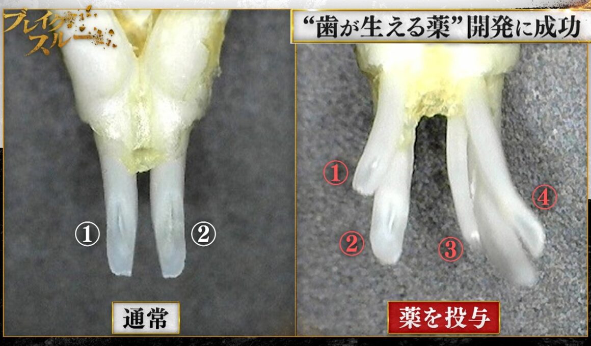 いま見直したい未来の医療〜“歯が生える薬”の実用化を目指す開拓者〜【「ブレイクスルー」再アップ】