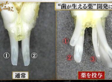 いま見直したい未来の医療〜“歯が生える薬”の実用化を目指す開拓者〜【「ブレイクスルー」再アップ】
