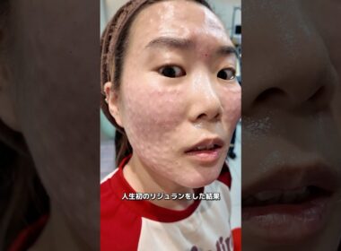 人生初のリジュランをした結果…🇰🇷本当にやってよかった。#shorts