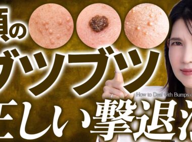 【絶対やめて】自己流で"顔のブツブツ"をケアすると危険です⚠️