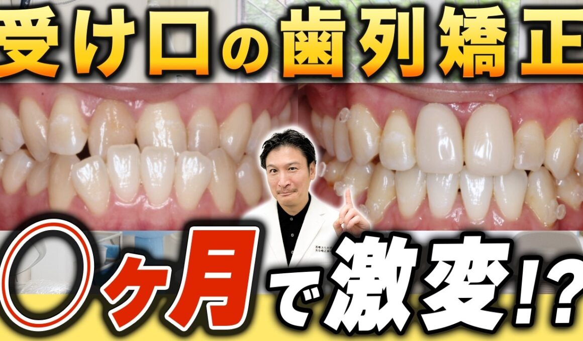 症例紹介！〜受け口編〜【歯列矯正を検討中の方必見！】
