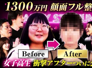 【完結編】1300万円顔面フル整形 女子高生 衝撃アフターついに公開！！藤森＆ひろゆき＆宮迫も仰天！【整形サバイバル#1】