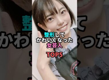 整形してかわいくなった女芸人TOP5 #お笑い #芸人 #お笑い芸人