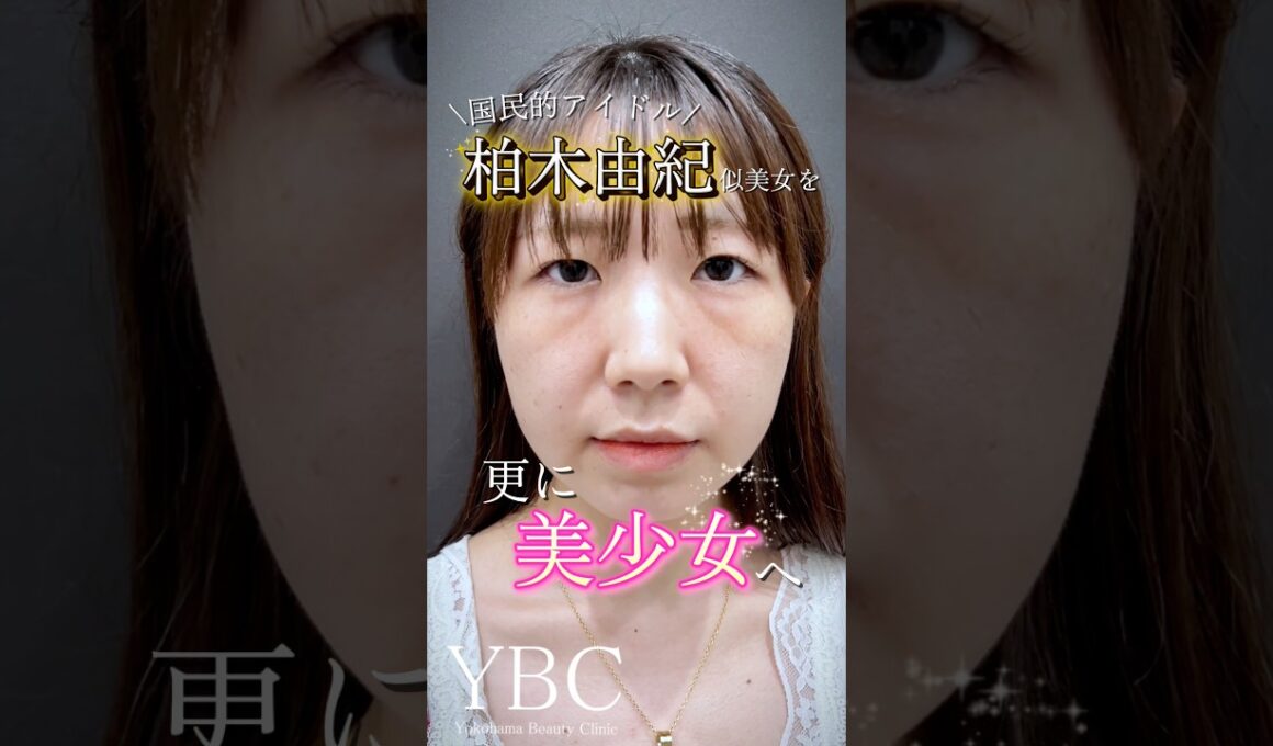 柏木由紀似美女を更に美しく✨#クマ取り #目の下のクマ #美容 #美女 #ダウンタイム#イソセン