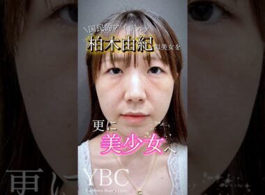 柏木由紀似美女を更に美しく✨#クマ取り #目の下のクマ #美容 #美女 #ダウンタイム#イソセン